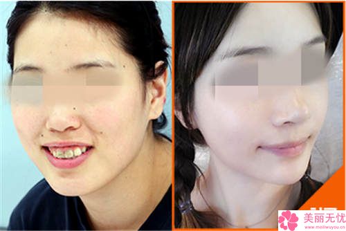 整容要花多少錢就整一張臉？深度解析全臉整形費(fèi)用構(gòu)成與預(yù)算攻略