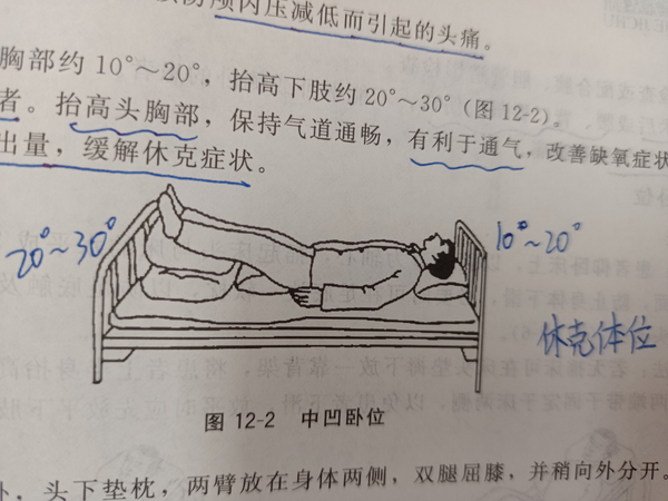 大S為何常臥？深度剖析其背后的多重原因與健康管理之道