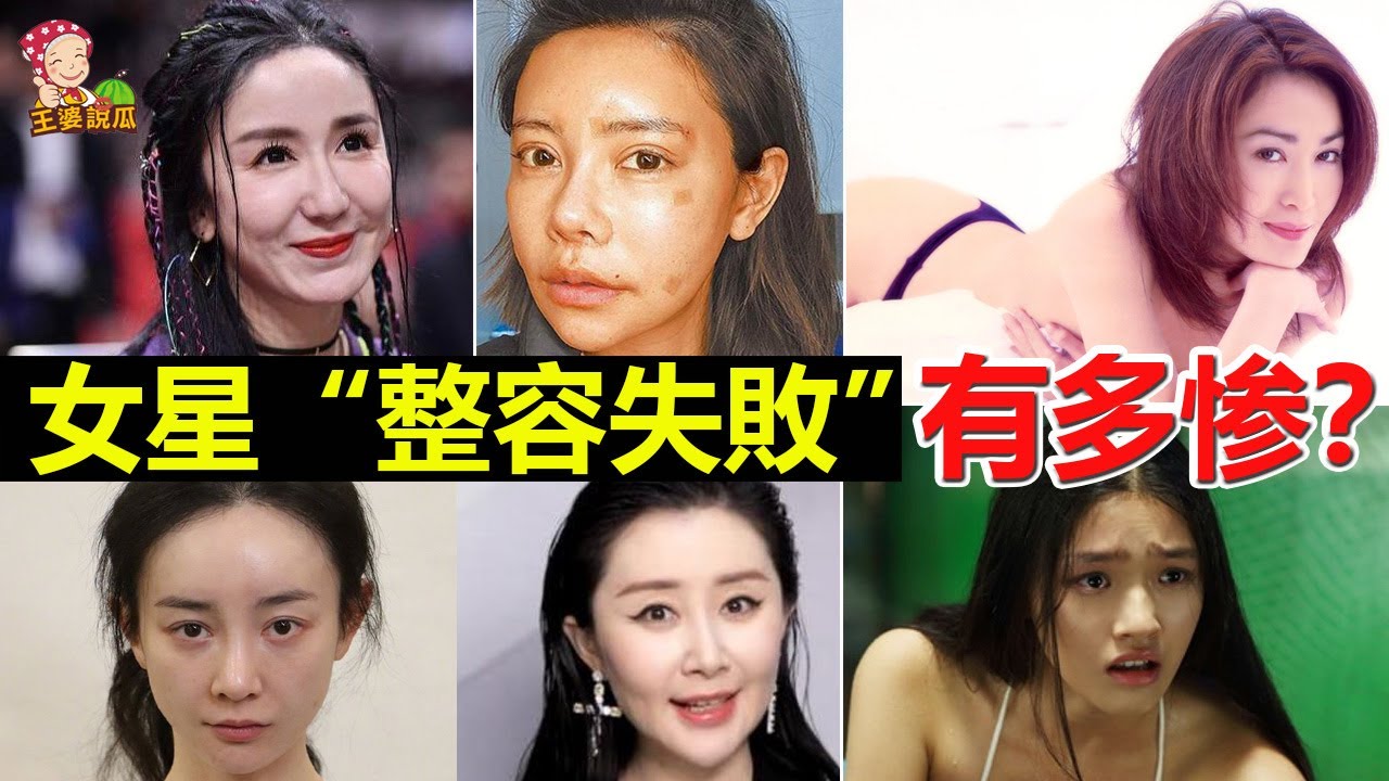 深度解析：整容很好看的女明星，如何做到自然美的典范？